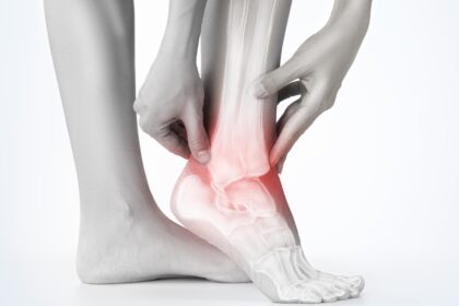 How Podiatrist Can Help With Different Types of Ankle Sprains
