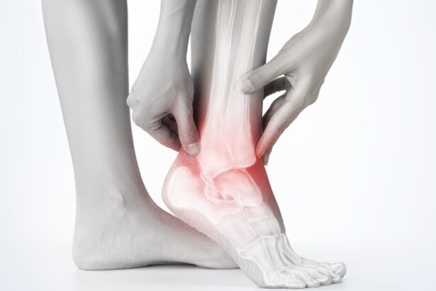How Podiatrist Can Help With Different Types of Ankle Sprains