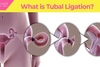 Is Tubal Reversal Right for You? Factors to Consider