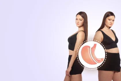 Navigating Bariatric Surgery Pre-Op and Post-Op