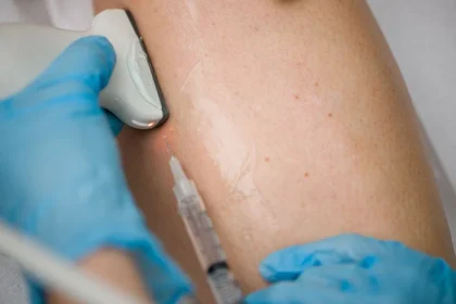 The Importance of Routine Check-ups at a Vein Clinic