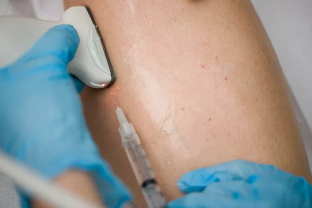 The Importance of Routine Check-ups at a Vein Clinic