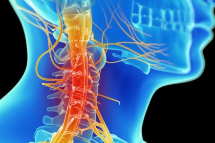 Understanding the Causes of Neck Pain