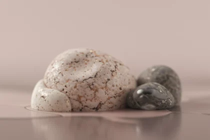 Understanding the Different Types of Kidney Stones