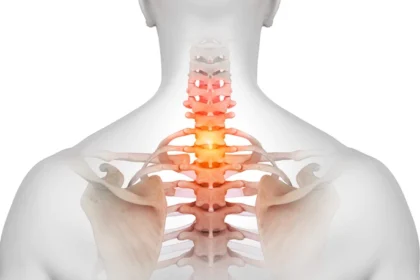 When Is Spine Surgery the Right Option?