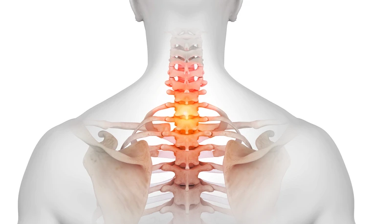 When Is Spine Surgery the Right Option?