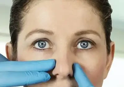 Common Myths and Misconceptions About Balloon Sinuplasty