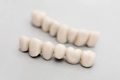 Selecting the Right Type of Dental Crowns for Your Needs