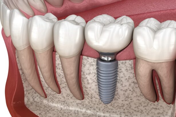 Understanding the Different Types of Fillings Available