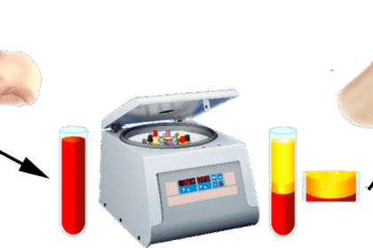 Understanding the Role of PRP in Tissue Regeneration