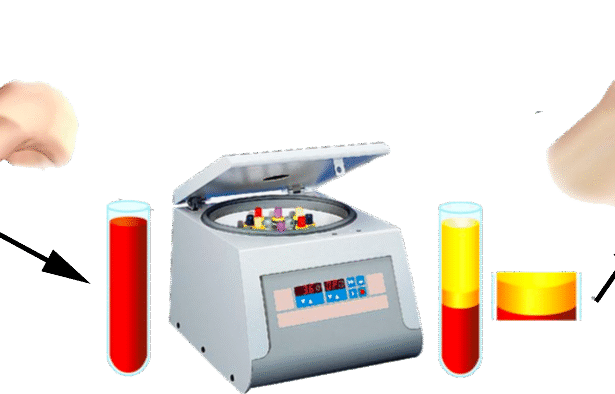 Understanding the Role of PRP in Tissue Regeneration