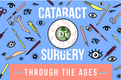 What to Expect Before, During, and After Cataract Surgery