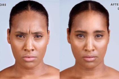 What to Expect Before and After Skin Cancer Surgery