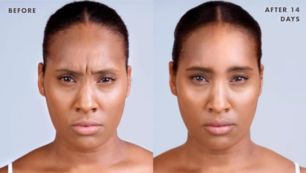 What to Expect Before and After Skin Cancer Surgery