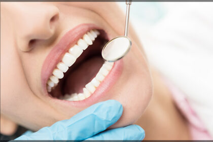 When To Get Cosmetic Dentistry