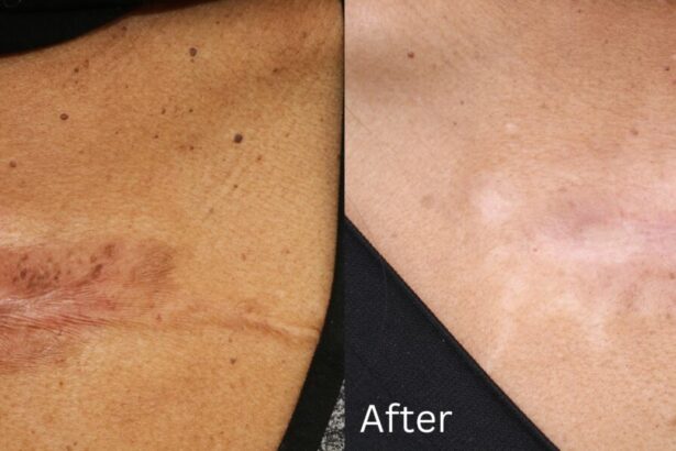 Long-Term Solutions for Scar Correction Post-Surgery