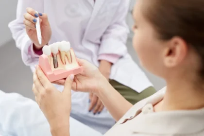 The Long-Term Benefits of Dental Implants for Oral Health