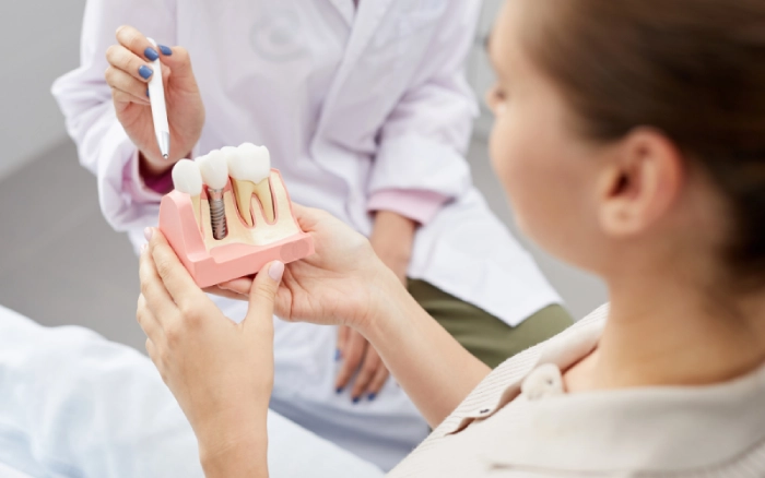 The Long-Term Benefits of Dental Implants for Oral Health