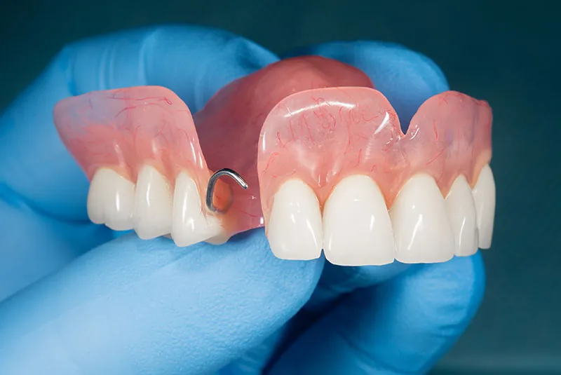 Understanding the Different Types of Dentures Available Today