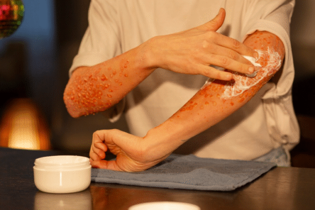 Holistic Approaches for Managing Psoriasis Symptoms