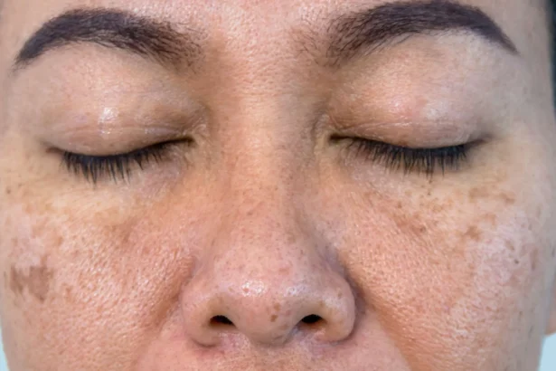 Why Is Your Skin So Dry? Top Causes Explained