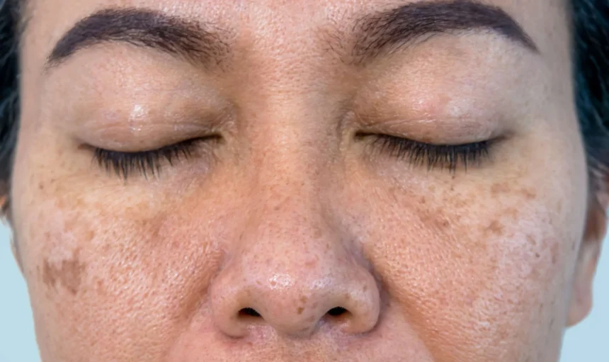 Why Is Your Skin So Dry? Top Causes Explained